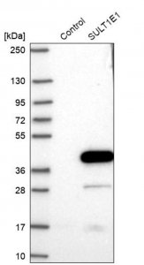 Anti-SULT1E1 antibody produced in rabbit HPA028213-100UL