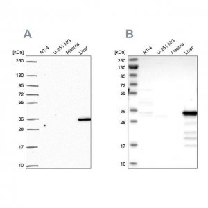 Anti-SULT2A1 antibody produced in rabbit 