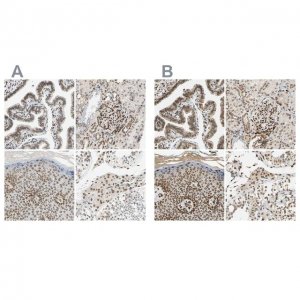 ANTI-SUN1 antibody produced in rabbit 