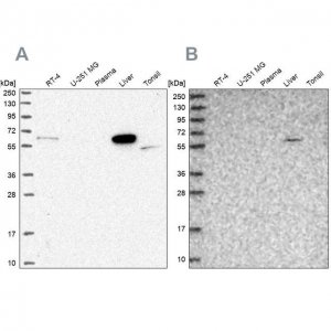 Anti-SUOX antibody produced in rabbit HPA038208-100UL
