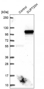Anti-SUPT20H antibody produced in rabbit 