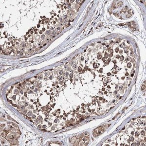 Anti-SUPT20H antibody produced in rabbit 