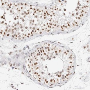 Anti-SUPT3H antibody produced in rabbit 