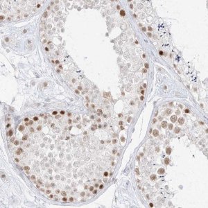 Anti-SUPT5H antibody produced in rabbit HPA029273-100UL