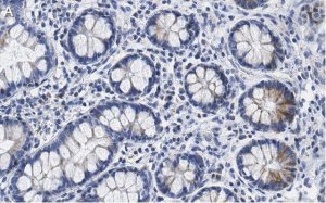 Anti-SUPV3L1 Antibody, clone 2F5 ZooMAb Rabbit Monoclonal 