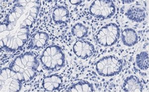 Anti-SUPV3L1 Antibody, clone 2F5 ZooMAb Rabbit Monoclonal 