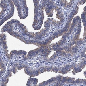 Anti-SVEP1 antibody produced in rabbit 