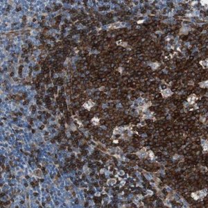 Anti-SWAP70 antibody produced in rabbit 