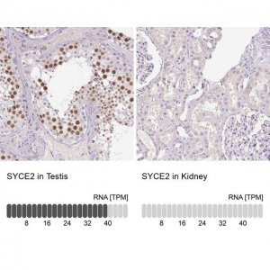 Anti-SYCE2 antibody produced in rabbit 