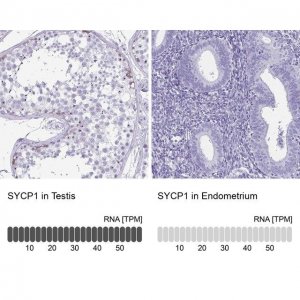 Anti-SYCP1 antibody produced in rabbit 