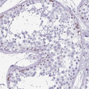 Anti-SYCP1 antibody produced in rabbit 