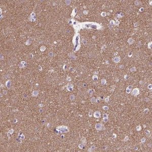 Anti-SYN1 antibody produced in rabbit HPA000397-100UL