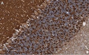Anti-Synapsin-1 Antibody, clone 1G5 ZooMAb Rabbit Monoclonal 