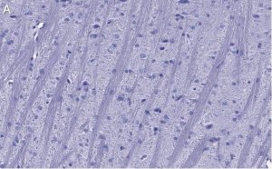 Anti-Synaptophysin Antibody, clone 1G7, ZooMAb Rabbit Monoclonal 