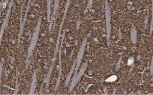 Anti-Synaptophysin Antibody, clone 1G7, ZooMAb Rabbit Monoclonal 