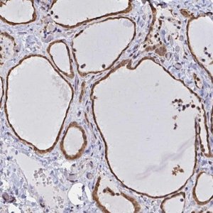 Anti-SYNCRIP antibody produced in rabbit 