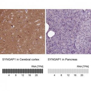 Anti-SYNGAP1 antibody produced in rabbit 