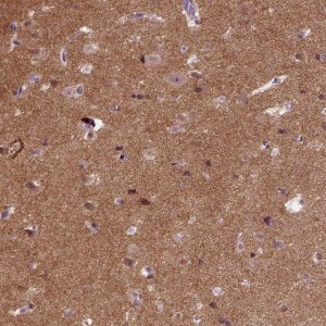 Anti-SYNGAP1 antibody produced in rabbit 