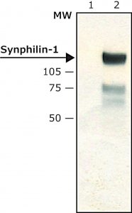 Anti-Synphilin-1 antibody produced in rabbit S5946-200UL