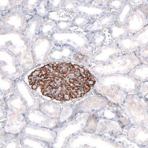 Anti-SYNPO antibody produced in rabbit 
