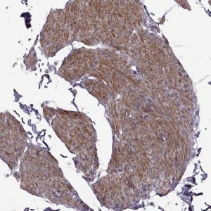 Anti-SYNPO2 antibody produced in rabbit 
