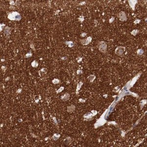 Anti-SYP antibody produced in rabbit 