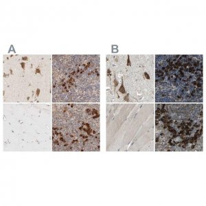 Anti-SYVN1 antibody produced in rabbit 