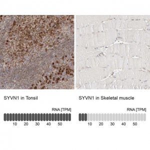 Anti-SYVN1 antibody produced in rabbit 