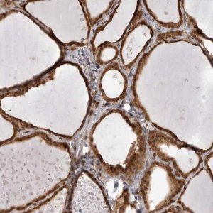 Anti-SZRD1 antibody produced in rabbit 