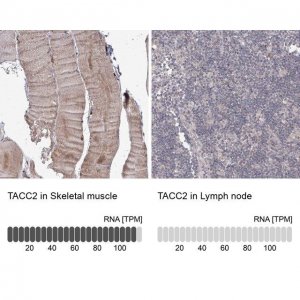 Anti-TACC2 antibody produced in rabbit HPA031021-100UL