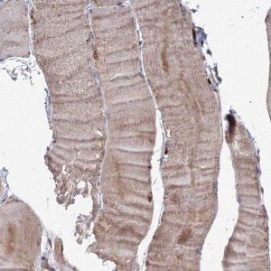 Anti-TACC2 antibody produced in rabbit HPA031021-100UL