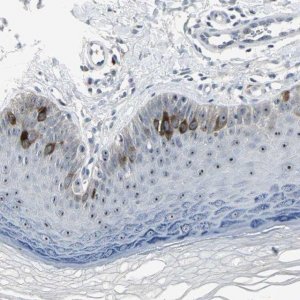 Anti-TACC3 antibody produced in rabbit HPA005781-100UL
