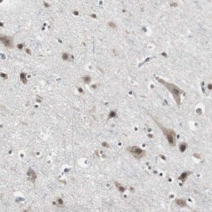 Anti-TAF7 antibody produced in rabbit HPA006429-100UL