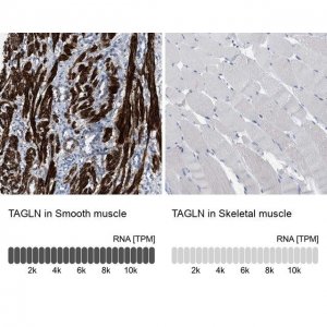 Anti-TAGLN antibody produced in rabbit 