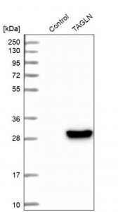 Anti-TAGLN antibody produced in rabbit 