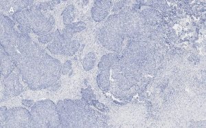 Anti-TAGLN Antibody, clone 1D10 , ZooMAb Rabbit Monoclonal 