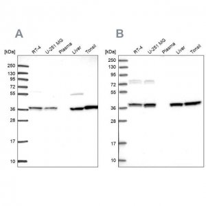 Anti-TALDO1 antibody produced in rabbit HPA048089-100UL