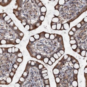 Anti-TAPBPL antibody produced in rabbit 