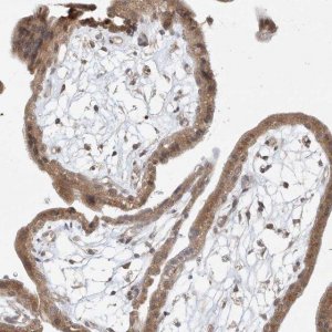 Anti-TASP1 antibody produced in rabbit 