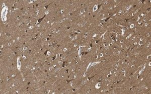Anti-Tau Antibody, clone 3D20 ZooMAb Rabbit Monoclonal 