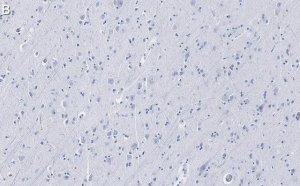 Anti-Tau Antibody, clone 3D20 ZooMAb Rabbit Monoclonal 