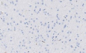 Anti-Tau-1 Antibody, clone PC1C6 ZooMAb Mouse Monoclonal 