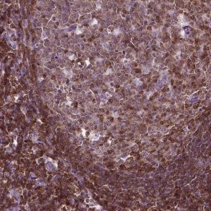 Anti-TBC1D10C antibody produced in rabbit 