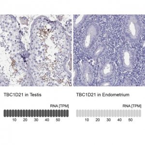 Anti-TBC1D21 antibody produced in rabbit 