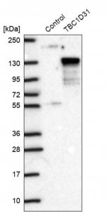 Anti-TBC1D31 antibody produced in rabbit 