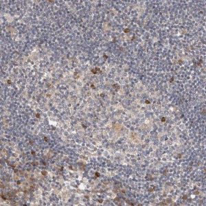 Anti-TBC1D31 antibody produced in rabbit 