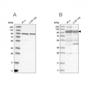 Anti-TBC1D5 antibody produced in rabbit 