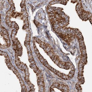 Anti-TBC1D5 antibody produced in rabbit 