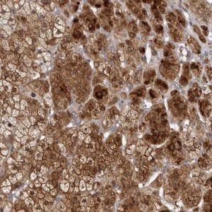 Anti-TBC1D8B antibody produced in rabbit 