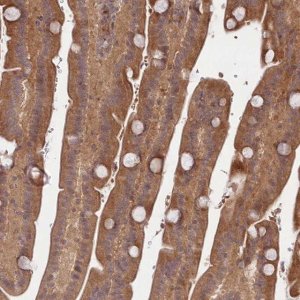 Anti-TBCA antibody produced in rabbit 